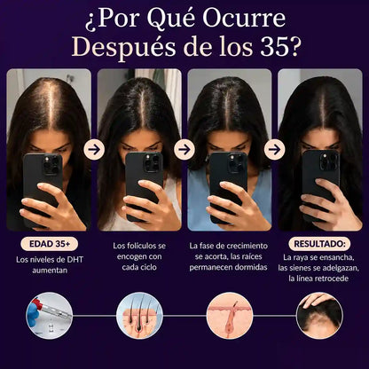 Crecimiento Avanzado del Cabello Para Mujeres